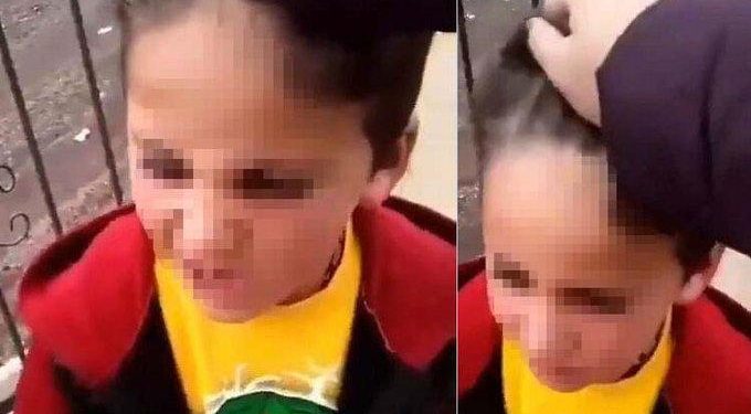 Saçı Uzun Diye 6 Yaşındaki Öğrencisine Şiddet Uygulayan Öğretmen Açığa Alındı