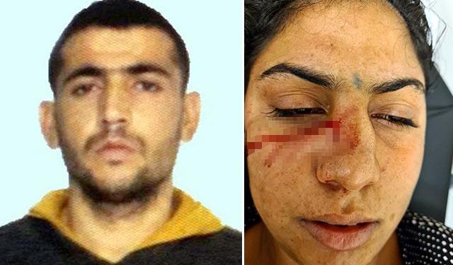 Kahvaltı Hazırlamadığını İddia Ettiği Eşini Darbedip, Bıçaklayan Koca Tutuklandı