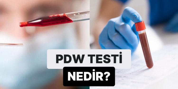 Trombositlerin Boyut Olarak Ne Kadar Benzer Olduğunu Gösteren Test: PDW Nedir?